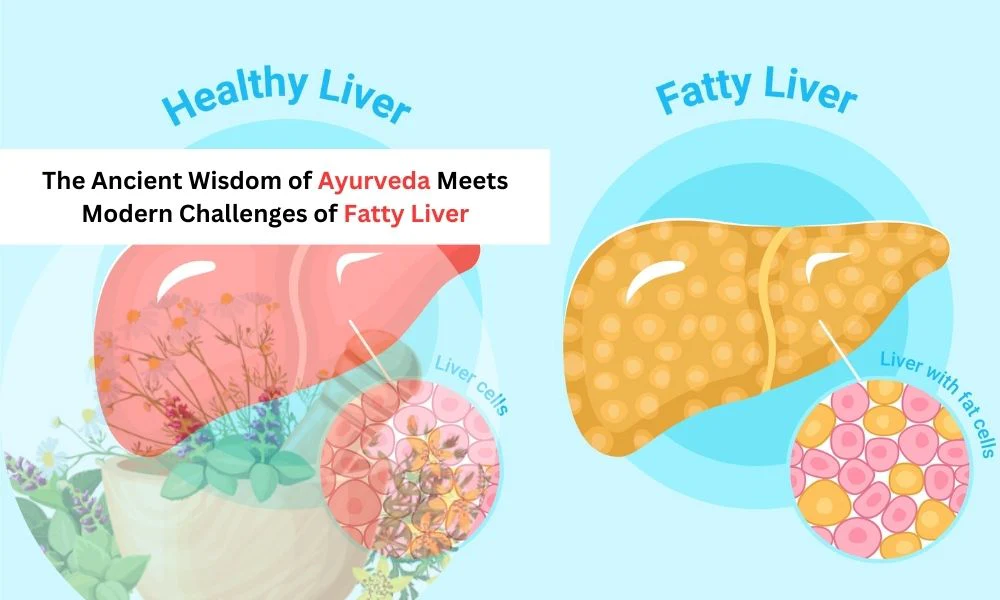 Fatty Liver and Its Remedies